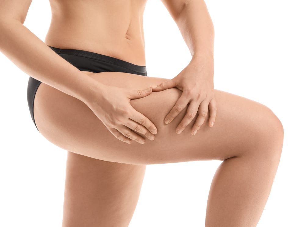 Facts About Cellulite