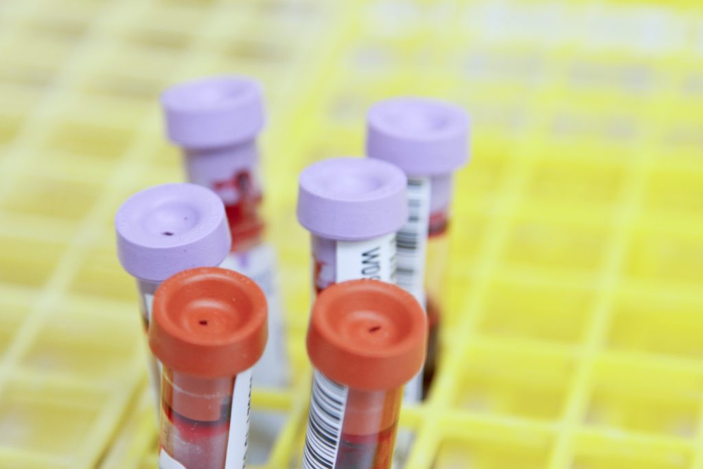 Test tube babies - On this day February 3rd