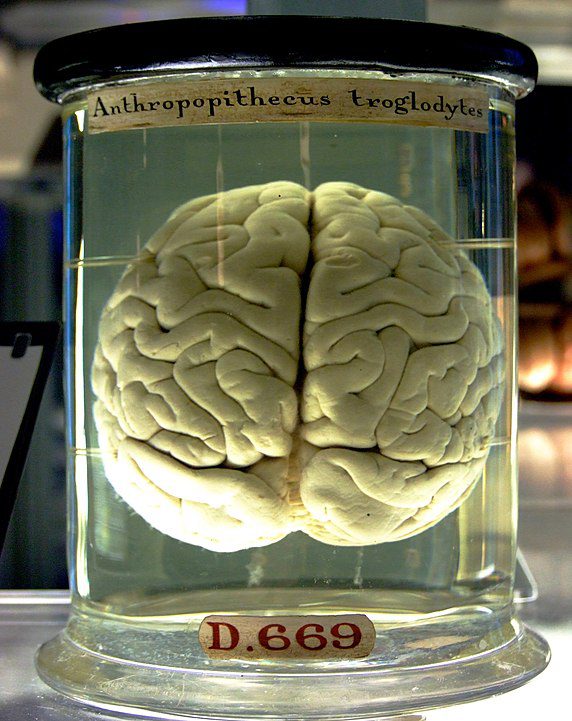 brain