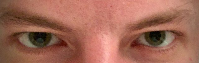 LSD eyes