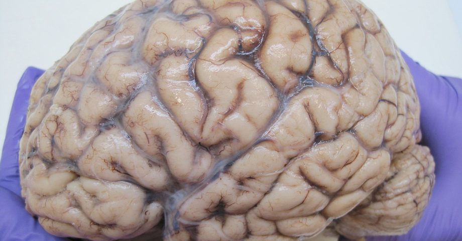 human brain