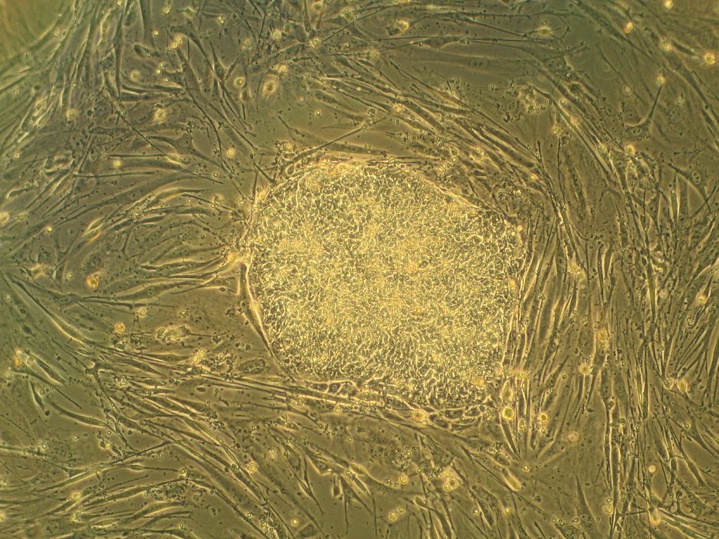 embryonic stem cells