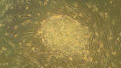 embryonic stem cells