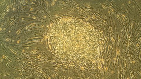 embryonic stem cells