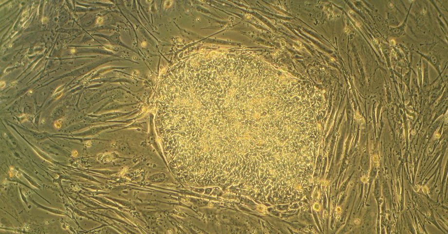 embryonic stem cells