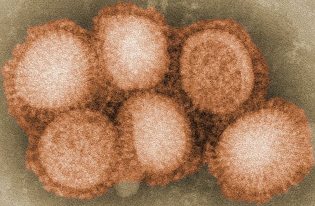 h1n1