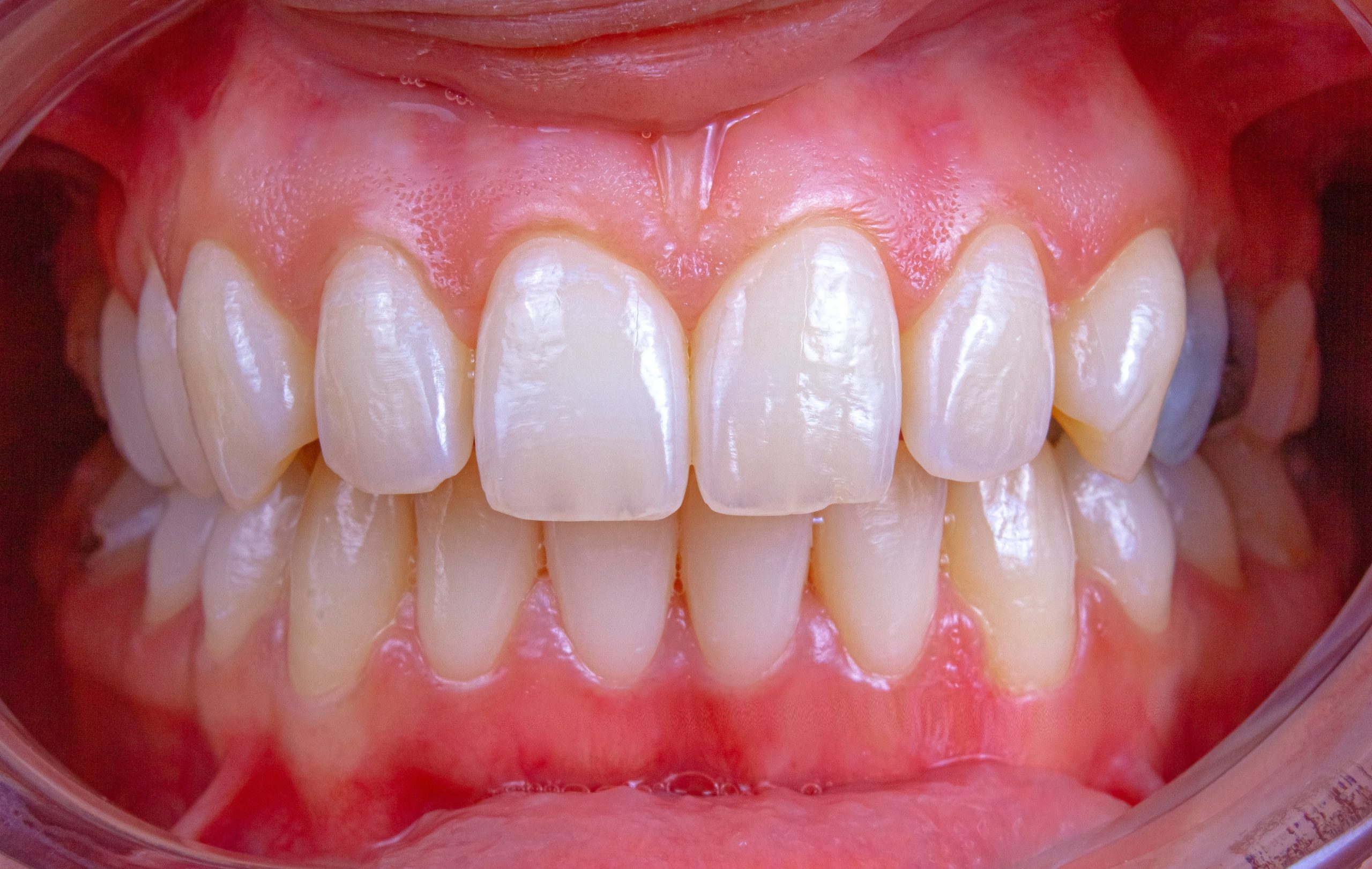 Facts About How Your Gums Are an Indicator of Your Overall Health